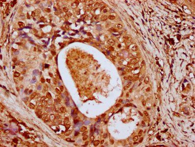 HIST1H4A Antibody