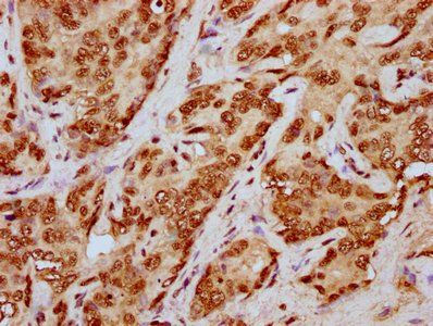 HIST1H4A Antibody