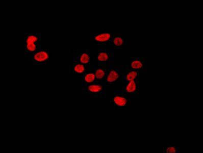 HIST1H4A (Ab-8) antibody