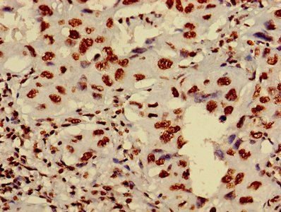 HIST1H4A (Ab-8) Antibody