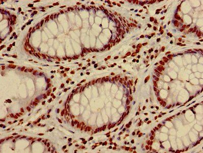 HIST1H4A (Ab-8) Antibody