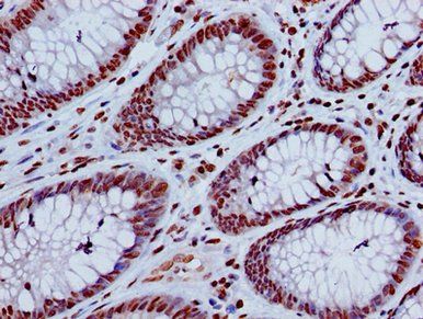 HIST1H4A (Ab-8) Antibody