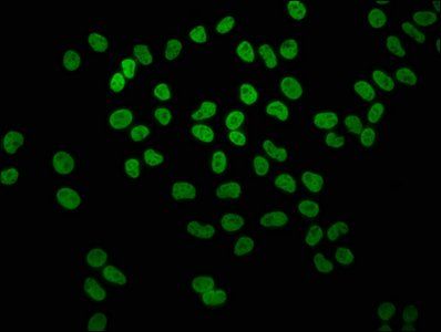 HIST1H4A (Ab-8) antibody