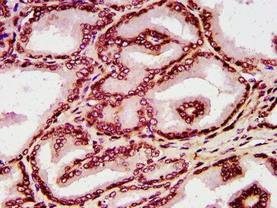 HIST1H4A (Ab-8) Antibody