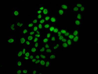 HIST1H4A (Ab-8) antibody