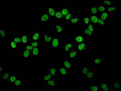 HIST1H4A (Ab-8) antibody