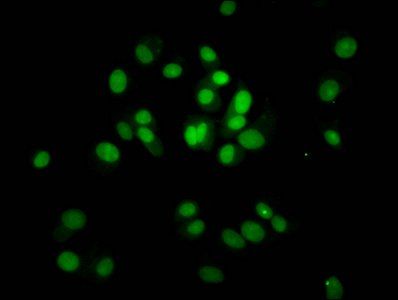 HIST1H4A (Ab-8) Antibody
