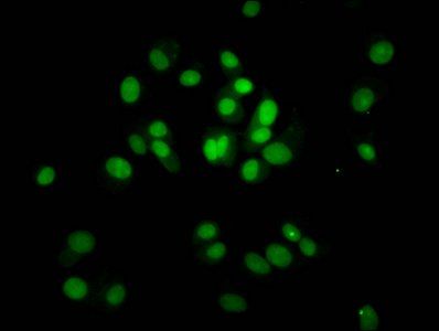 HIST1H4A (Ab-8) antibody