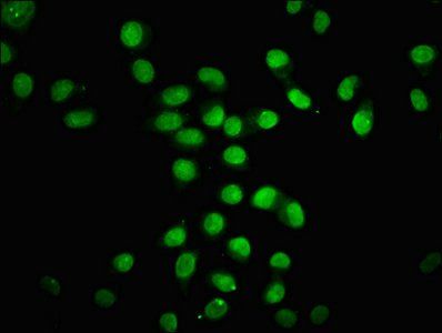 HIST1H4A (Ab-8) Antibody