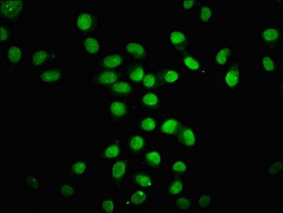 HIST1H4A (Ab-8) antibody