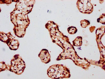 HIST1H4A (Ab-8) Antibody