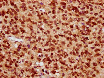 HIST1H4A (Ab-8) Antibody