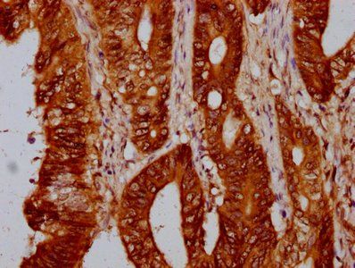 HIST1H4A Antibody