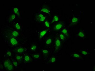 HIST1H4A Antibody
