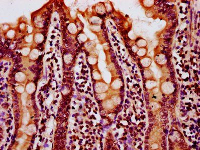 HIST1H4A Antibody