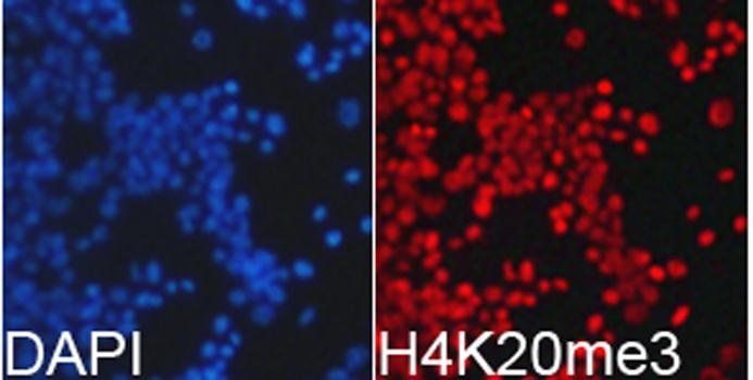 TriMethyl-Histone H4-K20 antibody