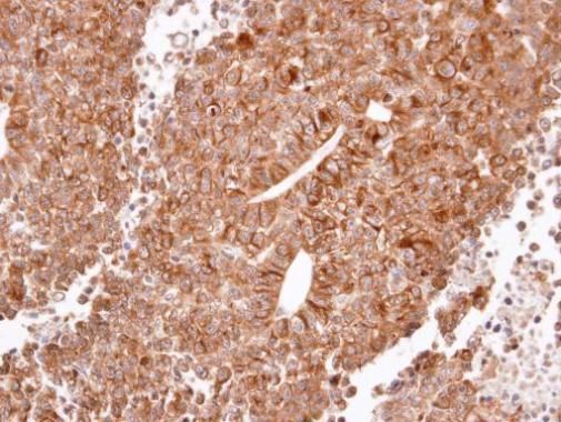 Histamine H2 Receptor antibody [N1], N-term