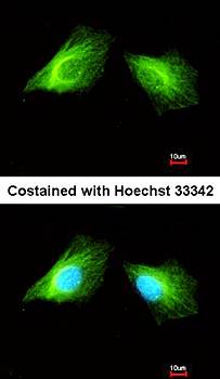 Histamine H2 Receptor antibody