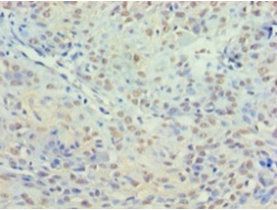 Histone deacetylase 3 antibody