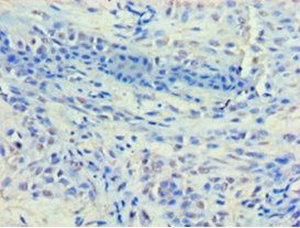 Histone deacetylase 8 antibody