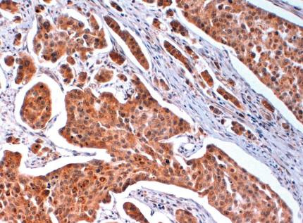 Rabbit Human Histone H2A.x (S140) Antibody