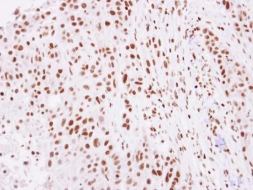 Histone H2A.Z antibody
