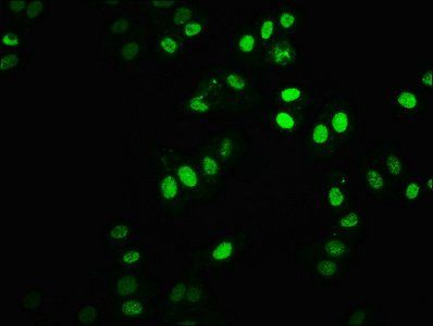 HIST1H2BC Antibody