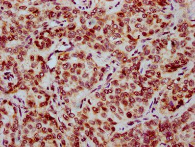 HIST1H2BC Antibody