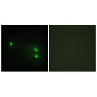 Histone H2B Antibody