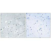 Histone H2B Antibody