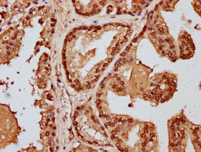 HIST1H3A (Ab-128) Antibody