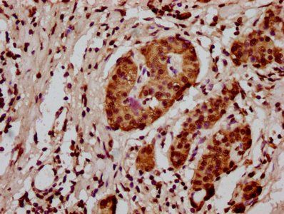 HIST1H3A (Ab-128) Antibody