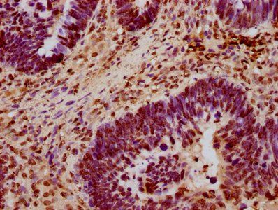 HIST1H3A (Ab-63) Antibody
