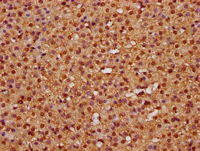 HIST1H3A (Ab-63) Antibody