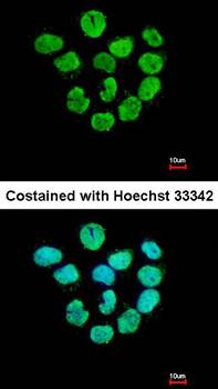 Histone H2A.Z/H2A.F/Z antibody