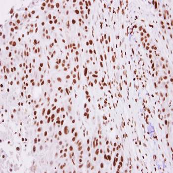 Histone H2A.Z/H2A.F/Z antibody