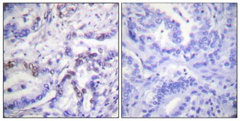 Histone H3 (Phospho-Thr3) Antibody