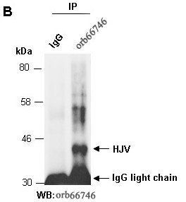 HJV antibody