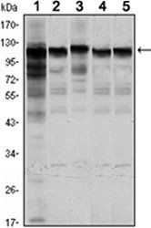 HK1 Antibody