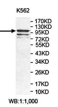 HK1 antibody