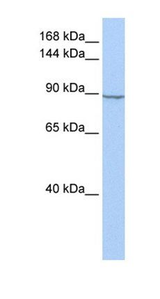 HK2 antibody