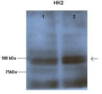 HK2 antibody