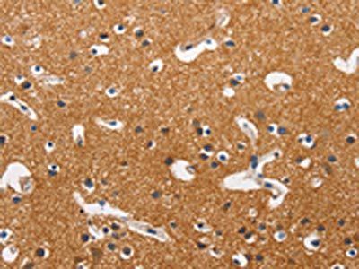 HK2 Antibody
