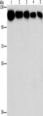 HK2 antibody