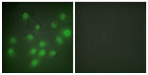 HKR1 Antibody