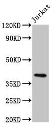 HLA-G Antibody