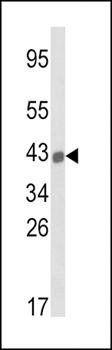 HLA-A antibody