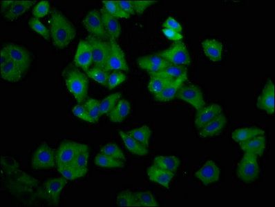 HLA-C Antibody