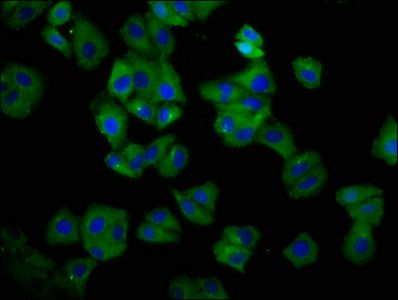 HLA-C antibody