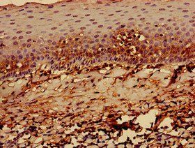 HLA-C Antibody